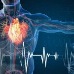 Kenali Apa Itu Intervensi Kardiologi Pada Jantung